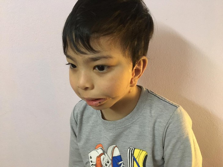 - Ảnh 3. - Ảnh 3.