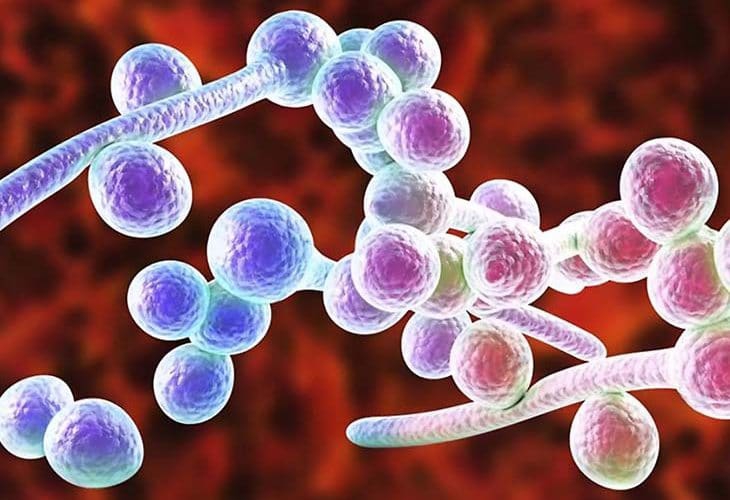 Các bệnh thường gặp do nấm Candida - Ảnh 3. Các bệnh thường gặp do nấm Candida - Ảnh 3.