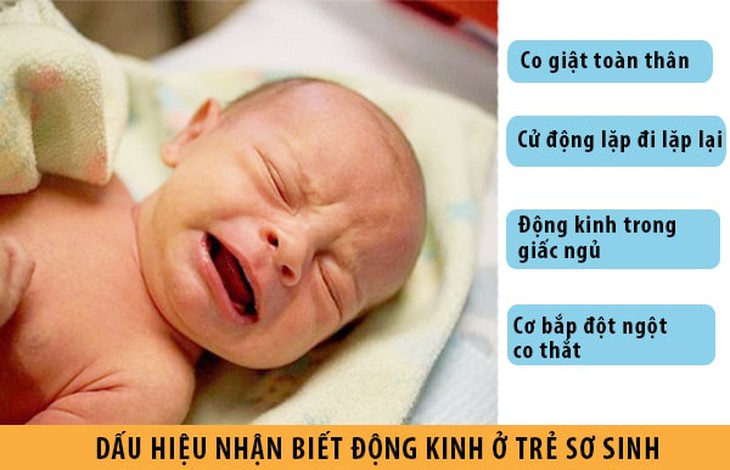 Co giật ở trẻ sơ sinh bệnh gì? - Ảnh 4.