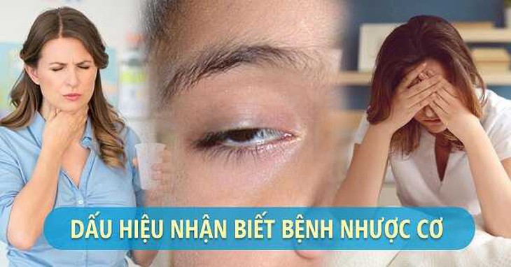 Yếu mỏi các cơ vận động - Thận trọng với bệnh nhược cơ - Ảnh 3.