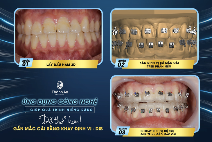 Bác sĩ Phan Trung Tiệp: Tôi muốn hướng tới một quy trình niềng răng "êm ái" hơn - Ảnh 3. Bác sĩ Phan Trung Tiệp: Tôi muốn hướng tới một quy trình niềng răng "êm ái" hơn - Ảnh 3.