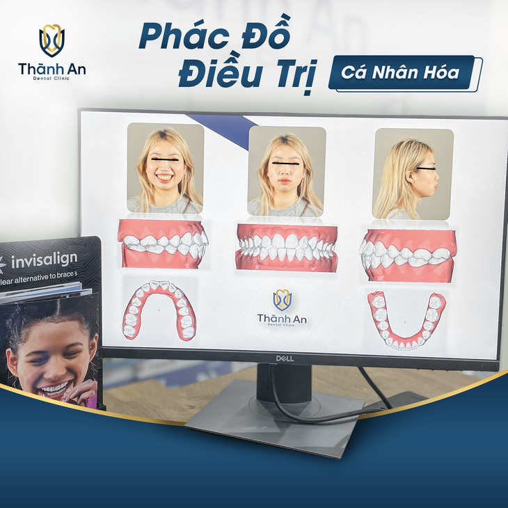 Bác sĩ Phan Trung Tiệp: Tôi muốn hướng tới một quy trình niềng răng "êm ái" hơn - Ảnh 4. Bác sĩ Phan Trung Tiệp: Tôi muốn hướng tới một quy trình niềng răng "êm ái" hơn - Ảnh 4.