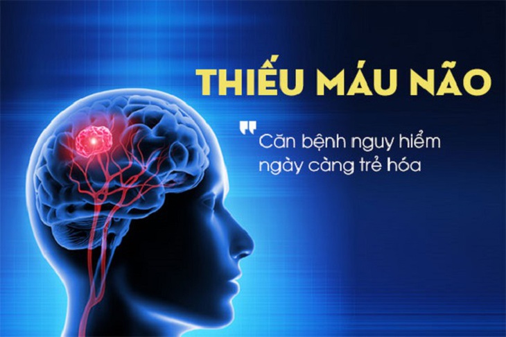 Làm thế nào để hạn chế biến chứng do cơn thiếu máu não thoáng qua? - Ảnh 1. Làm thế nào để hạn chế biến chứng do cơn thiếu máu não thoáng qua? - Ảnh 1.