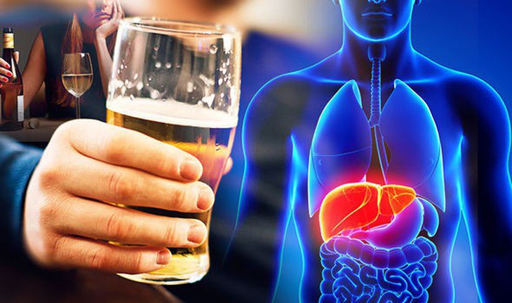 10 lựa chọn thực phẩm phổ biến cho người bị bệnh gan nhiễm mỡ - Ảnh 1.