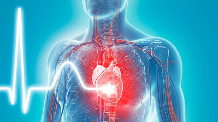 Chuyên gia chỉ ra những ảnh hưởng đến tim mạch sau nhiễm COVID-19 - Ảnh 3. Chuyên gia chỉ ra những ảnh hưởng đến tim mạch sau nhiễm COVID-19 - Ảnh 3.