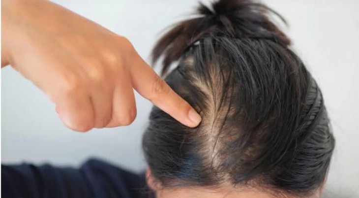 duỗi tóc 1