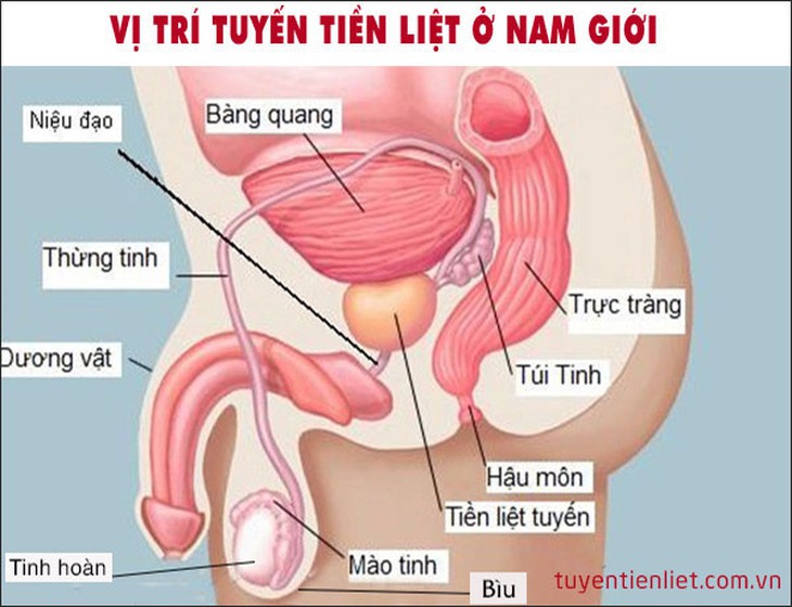 Nhận biết các bất thường của tuyến tiền liệt mà nam giới cần biết - Ảnh 2.