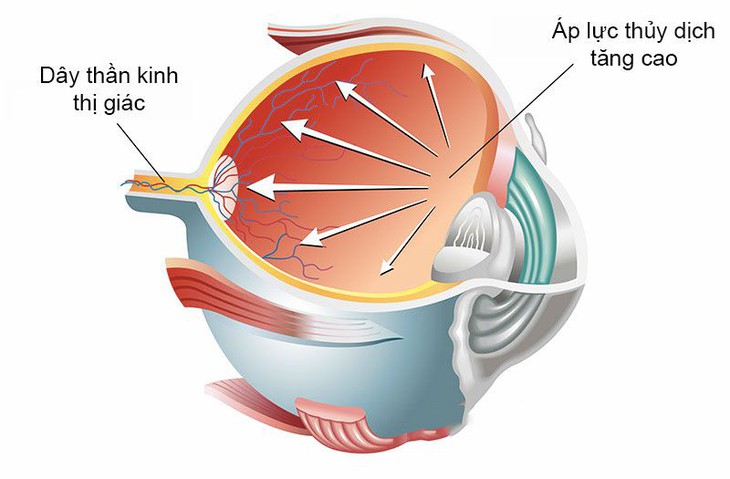 Điều trị COVID-19 và những hệ lụy không ngờ cho mắt - Ảnh 3.