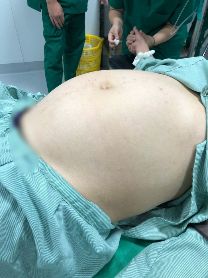 Bụng ngày càng to, đi khám phát hiện khối u buồng trứng nặng 12 kg - Ảnh 1. Bụng ngày càng to, đi khám phát hiện khối u buồng trứng nặng 12 kg - Ảnh 1.