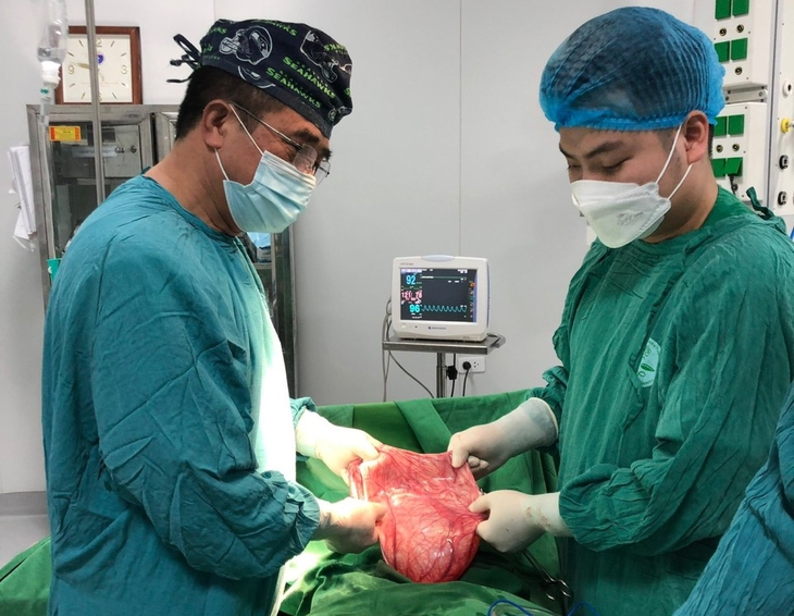 Bụng ngày càng to, đi khám phát hiện khối u buồng trứng nặng 12 kg - Ảnh 2. Bụng ngày càng to, đi khám phát hiện khối u buồng trứng nặng 12 kg - Ảnh 2.