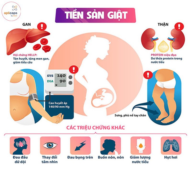 Ngăn chặn biến chứng tiền sản giật nguy hiểm ở thai phụ nếu phát hiện sớm - Ảnh 2. Ngăn chặn biến chứng tiền sản giật nguy hiểm ở thai phụ nếu phát hiện sớm - Ảnh 2.