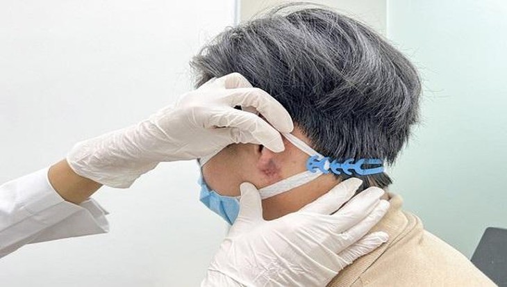 Hiểm họa từ trào lưu nam giới tạo tai Phật bằng tiêm filler - Ảnh 1.