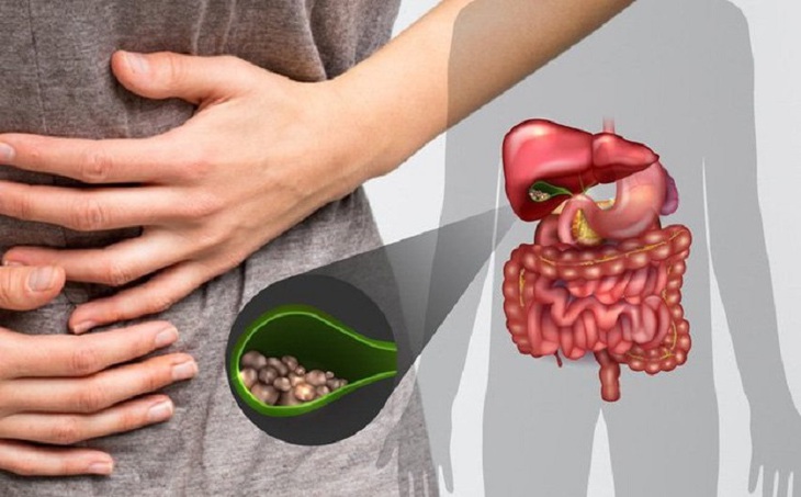Trào ngược dịch mật: nhận biết, nguyên nhân và những lưu ý - Ảnh 1. Trào ngược dịch mật: nhận biết, nguyên nhân và những lưu ý - Ảnh 1.