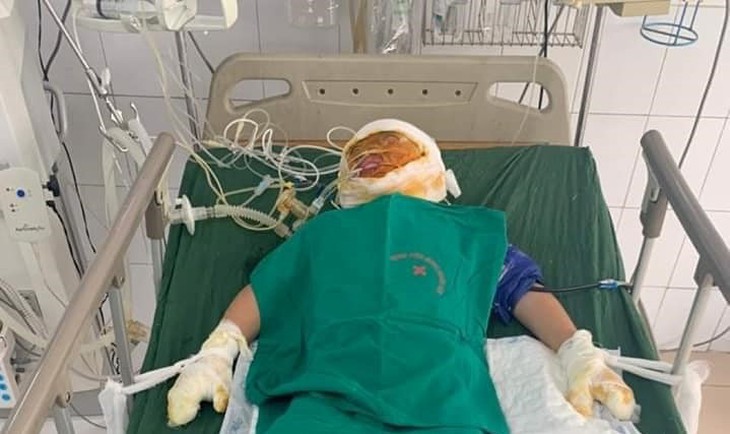 MS 739: 3 anh em mồ côi ở nhà không may bị chập điện cháy nhà khiến một người mất, một người cấp cứu trong nguy kịch - Ảnh 2. MS 739: 3 anh em mồ côi ở nhà không may bị chập điện cháy nhà khiến một người mất, một người cấp cứu trong nguy kịch - Ảnh 2.