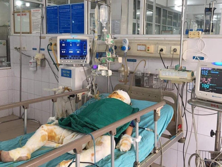 MS 739: 3 anh em mồ côi ở nhà không may bị chập điện cháy nhà khiến một người mất, một người cấp cứu trong nguy kịch - Ảnh 3. MS 739: 3 anh em mồ côi ở nhà không may bị chập điện cháy nhà khiến một người mất, một người cấp cứu trong nguy kịch - Ảnh 3.