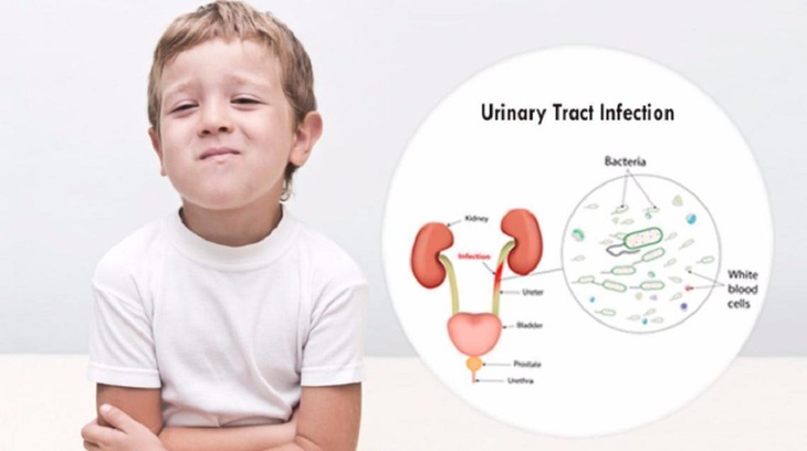 Nhiễm trùng tiểu ở trẻ: Nhận biết, nguyên nhân và những lưu ý mà cha mẹ cần biết - Ảnh 2. Nhiễm trùng tiểu ở trẻ: Nhận biết, nguyên nhân và những lưu ý mà cha mẹ cần biết - Ảnh 2.