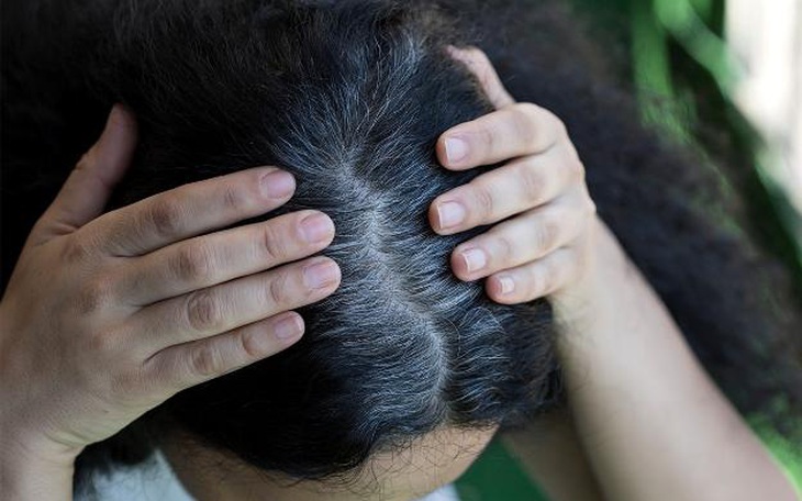 Thủ thuật ngăn ngừa tóc bạc sớm