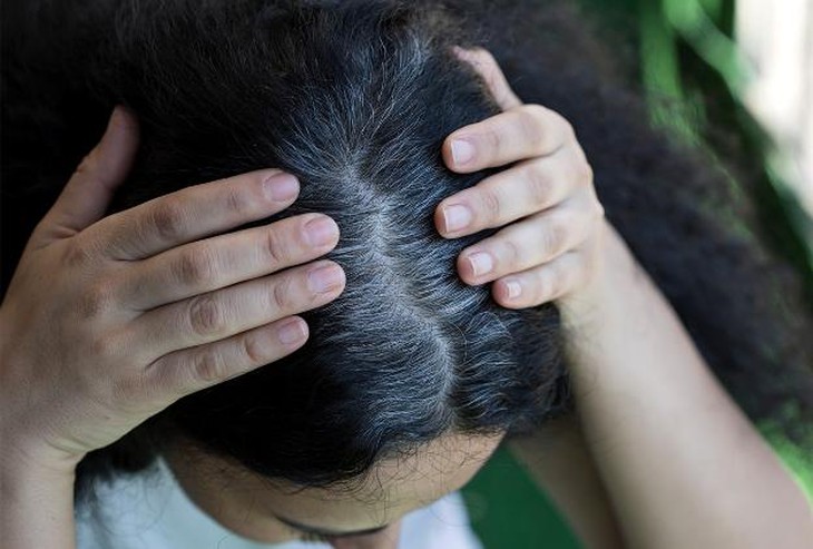 tóc bạc