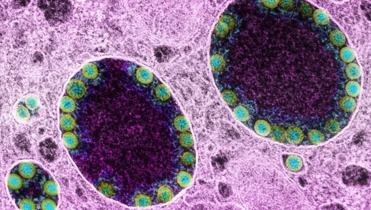 WHO: Biến thể mới XE có thể là phiên bản dễ lây lan nhất của virus SARS-CoV-2 - Ảnh 1.