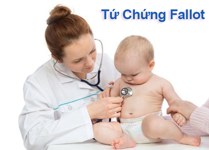 Những dấu hiệu nhận biết tứ chứng Fallot - Ảnh 4.