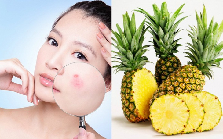 Muốn đẹp da, khỏe tóc, hãy ăn dứa! - Ảnh 4. Muốn đẹp da, khỏe tóc, hãy ăn dứa! - Ảnh 4.