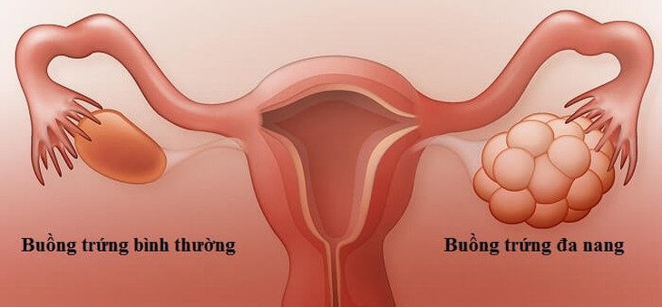 Rụng trứng kéo dài bao lâu mỗi tháng? - Ảnh 5.