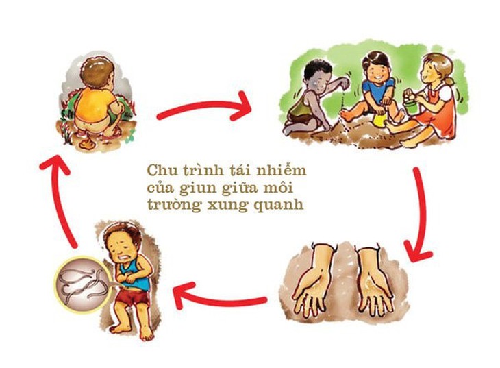Đau ngứa hậu môn ở trẻ em do nhiễm giun kim, cách nào để trị? - Ảnh 1.