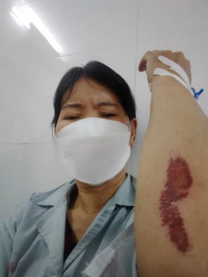 Điều tra nhóm côn đồ hành hung nhập viện vợ chồng một cụm phó dân cư - Ảnh 3.