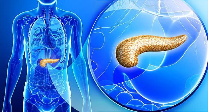 Bệnh đái tháo đường: Triệu chứng, nguyên nhân, điều trị và phòng bệnh - Ảnh 3.