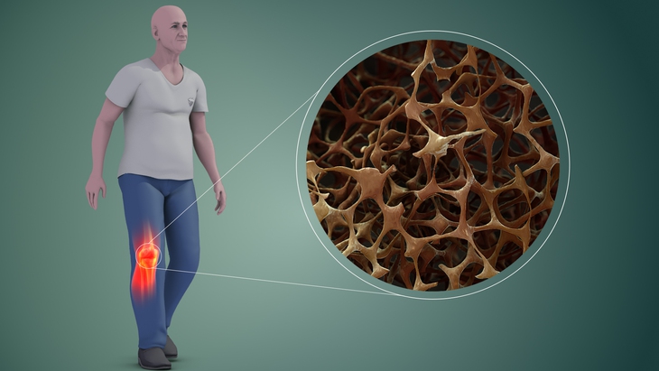 Thuốc loãng xương mới an toàn và ít tác dụng phụ từ hormone tự nhiên - Ảnh 1.