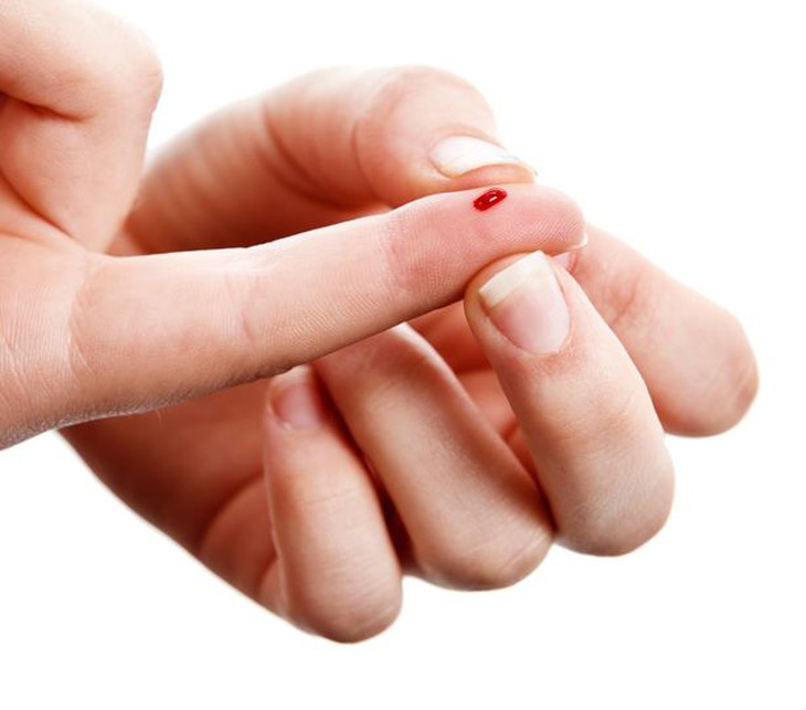 Người có nhóm máu A có tỷ lệ dương tính với virus SARS-CoV-2 cao hơn - Ảnh 1.