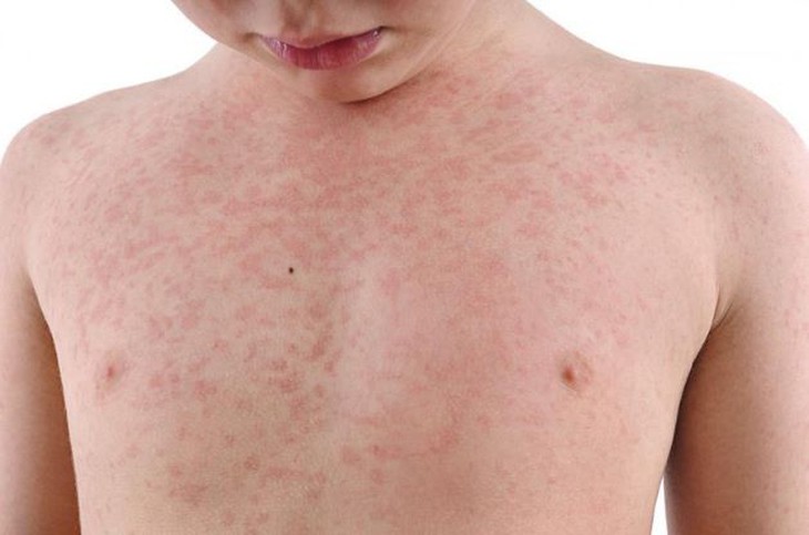 Vì sao trẻ bị rối loạn phổ tự kỷ? - Ảnh 5.