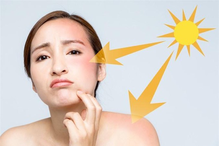 Chăm chỉ dùng kem chống nắng hàng ngày nhưng nếu mắc sai lầm này vừa mất tác dụng bảo vệ vừa hại da, nguy cơ bị các bệnh về da - Ảnh 2. Chăm chỉ dùng kem chống nắng hàng ngày nhưng nếu mắc sai lầm này vừa mất tác dụng bảo vệ vừa hại da, nguy cơ bị các bệnh về da - Ảnh 2.