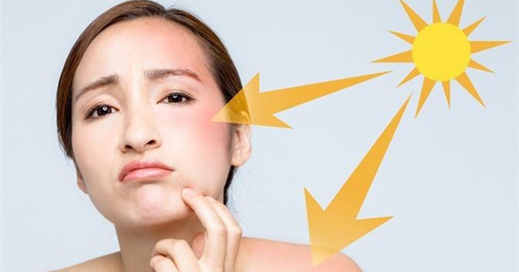 Dùng kem chống nắng sai cách biến "cứu tinh" thành "tội đồ" của da