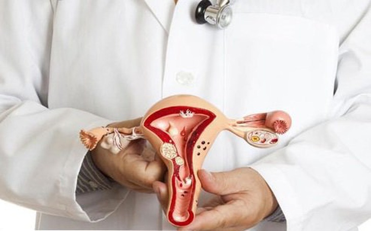 Phụ nữ tuổi mãn kinh với nỗi lo teo âm đạo - Dấu hiệu nhận biết và cách hạn chế