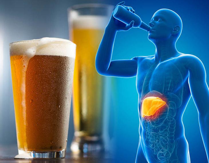 Ngoài hạn chế rượu bia, những thói quen nào giúp phòng bệnh gan hiệu quả? - Ảnh 1.