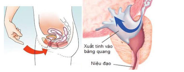 Nguyên nhân không ngờ khiến chàng trai trẻ mắc chứng “mất tích” tinh trùng, rối loạn cương dương - Ảnh 4. Nguyên nhân không ngờ khiến chàng trai trẻ mắc chứng “mất tích” tinh trùng, rối loạn cương dương - Ảnh 4.