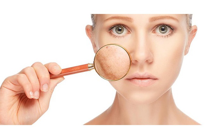 Tác hại của ánh nắng với làn da và cách chống nắng toàn diện cho cơ thể