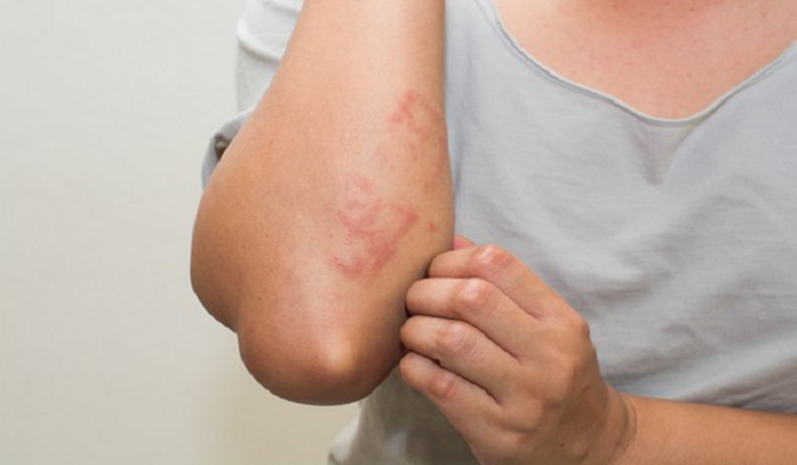 Mỗi ngày hồ bơi tiếp nhận rất nhiều lượt khách và trong số đó tiềm ẩn nhiều rủi ro về bệnh về da liễu, nấm ngứa. Mỗi ngày hồ bơi tiếp nhận rất nhiều lượt khách và trong số đó tiềm ẩn nhiều rủi ro về bệnh về da liễu, nấm ngứa.