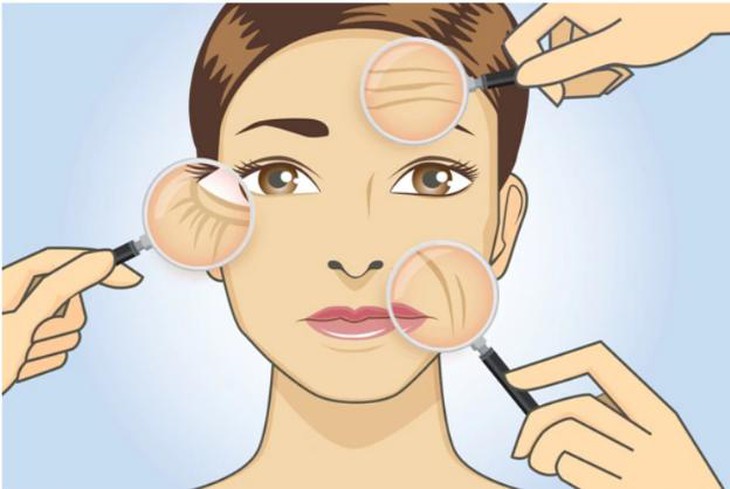 botox 3