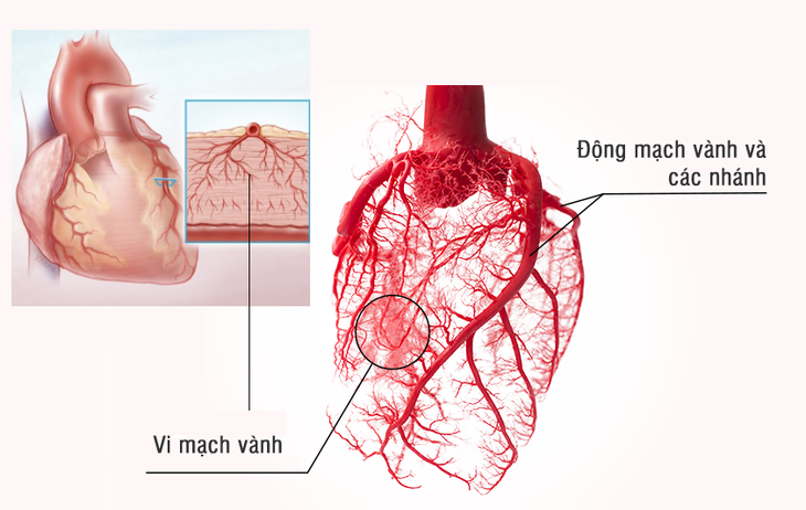 Hỗ trợ cải thiện tình trạng đau thắt ngực, thiếu máu cơ tim với chiết xuất từ thông Dahurian - Ảnh 1. Hỗ trợ cải thiện tình trạng đau thắt ngực, thiếu máu cơ tim với chiết xuất từ thông Dahurian - Ảnh 1.