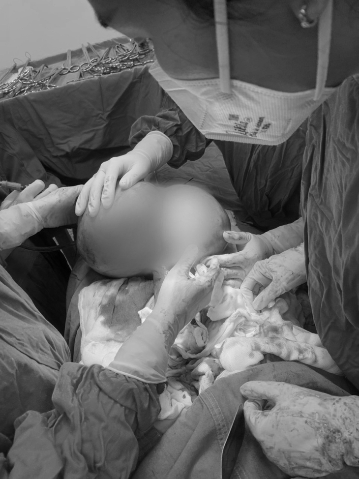 Bụng to bất thường, đi khám phát hiện khối u  5,5 kg - Ảnh 1.