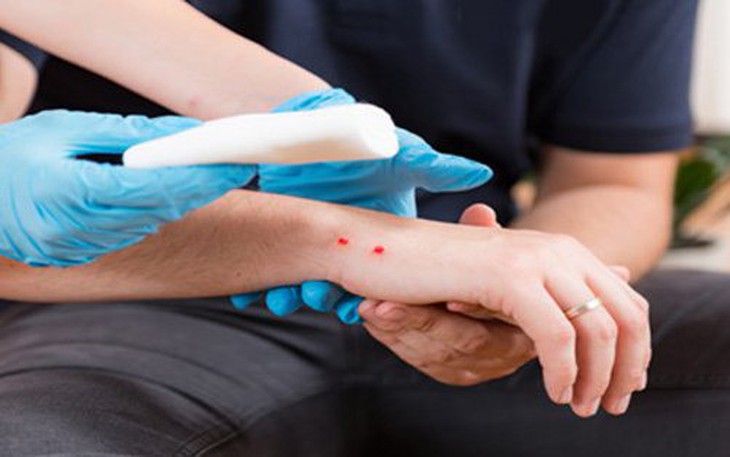 Cách sơ cứu những vết thương dễ gặp phải khi du lịch do côn trùng, động vật