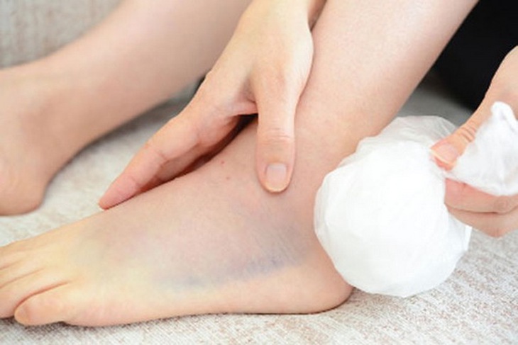 Sai lầm thường gặp chấn thương phần mềm cổ chân- Ảnh 1. Sai lầm thường gặp chấn thương phần mềm cổ chân- Ảnh 1.