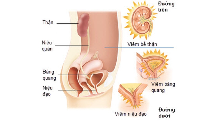 Đau xương sườn khi mang thai có phải là biến chứng nguy hiểm? - Ảnh 4.