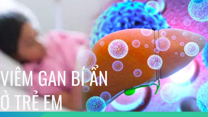 Chuyên gia gan mật Bệnh viện Nhi TW lưu ý gì với cha mẹ để phòng bệnh viêm gan cấp tính 'bí ẩn' ở trẻ? - Ảnh 1.