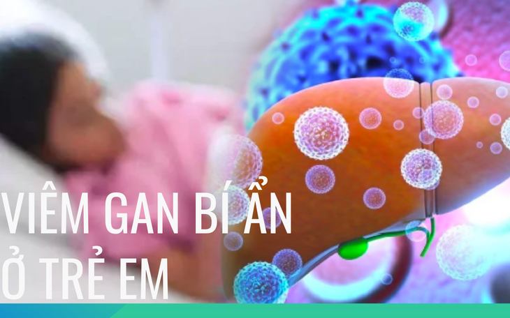 Bộ Y tế khuyến cáo cách phòng chống bệnh viêm gan cấp tính "bí ẩn" ở trẻ em
