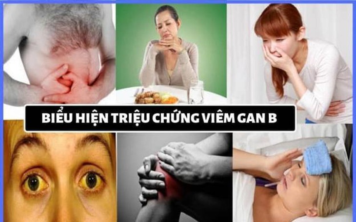 Viêm gan B - Nguyên nhân, triệu chứng và cách điều trị khoa học