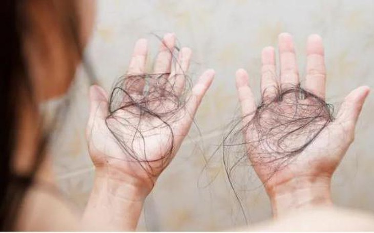 Rụng tóc, không phải lúc nào cũng đáng lo