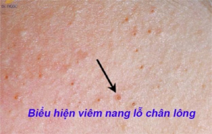 photo-1652971017618